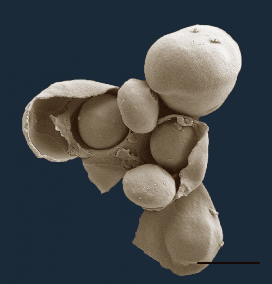 Οι επιστήμονες λύνουν επιτέλους το μυστήριο των μικροσκοπικών κεντρομερών της ζύμης (sciencedaily.com)